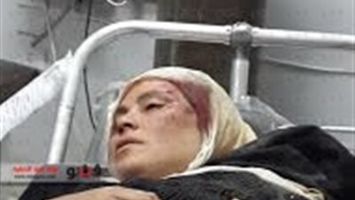 بالفيديو والصور.. تفاصيل الاعتداء على سيدة مؤيدة للسيسي بالشرقية