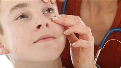 علامات الإصابة بالأنيميا وأهم طرق علاجها في أسرع وقت