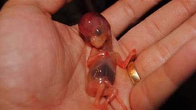 استشاري حقن مجهري يوضح بعض العوامل المتسببة في الإجهاض المتكرر