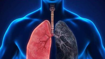 طرح  دواء مصري لعلاج مرضى الانسداد الرئوي المزمن