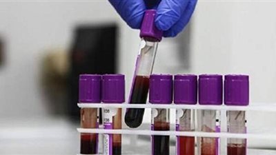 ابتكار اختبار للكشف عن السرطان قبل 4 سنوات من بدايته