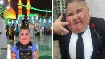 صدمة على مواقع التواصل بعد وفاة الطفل العراقي 