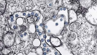 أكثر من 3.5 ألف حالة تعاف من فيروس كورونا في فلسطين