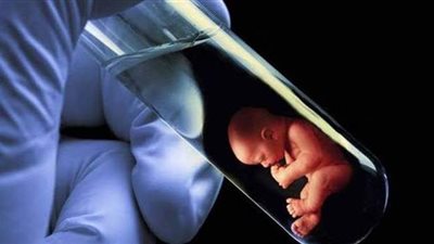 مرور ٤٢ عاما على ميلاد أول طفل أنابيب