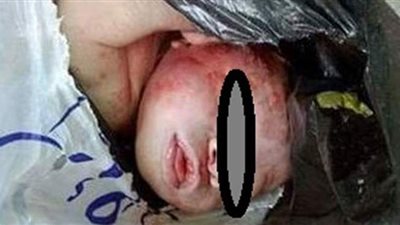 العثور علي طفل حديث الولادة في مقلب قمامة بالإسكندرية