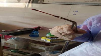 استخراج جزء مكسور من المسحة بأنف مريضة كورونا في مستشفى النيل بشبرا الخيمة