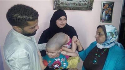 القباج توجه فريق التدخل السريع بتقديم الدعم لأسرة التوأم الملتصق من الرأس