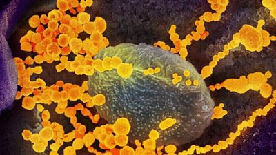 كورونا يجبر أكبر شركة مصدرة للحوم الخنزير في أوروبا على إغلاق أبوابها