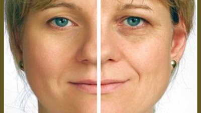 أسرار الإصابة بالشيخوخة المبكرة