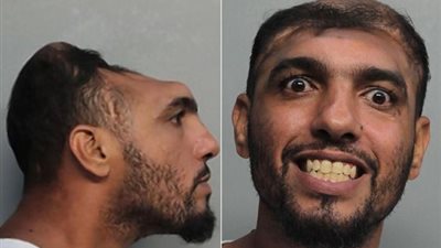 بالصور.. لقطات مذهلة لرجل بنصف رأس متهم بالشروع في القتل