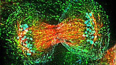 الكشف عن 11 نوعًا من سرطان الدم النخاعي