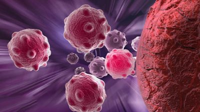 5 أنواع من السرطان تنتقل عبر العلاقة الحميمية