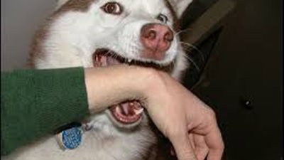 الإسعافات الأولية عند إصابة طفلك بـ«عضة كلب»