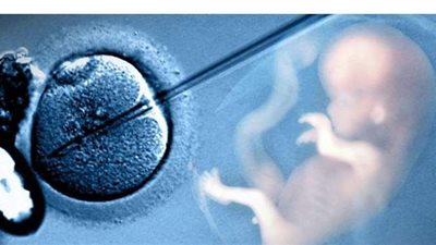 هكذا يتم تحديد جنس الجنين بالحقن المجهري بنسبة نجاح 90%
