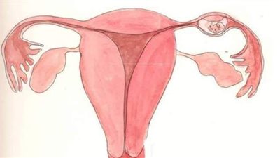 أسباب الحمل خارج الرحم وأهم الأعراض