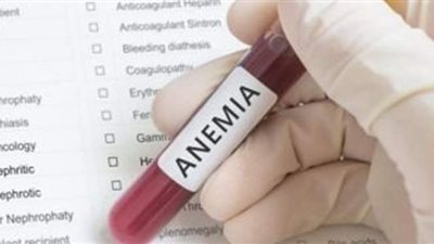 اهم أسباب الإصابة بالأنيميا والأعراض وطرق العلاج