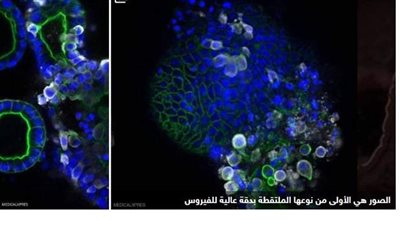 ارتفاع إجمالي الإصابات بفيروس كورونا إلى نحو 325 ألف حالة فى إيران