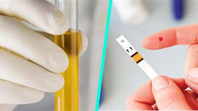 أستاذ جراحة أوعية يوضح الفرق بين سكر الدم وسكر البول