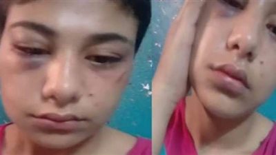 18 أغسطس.. أولى جلسات محاكمة المتهمين في قضية منة عبد العزيز