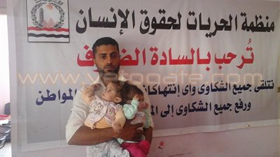بالصور.. رحلة معاناة توءم ملتصق بالرأس في الشرقية