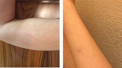 إصابة ميريام فارس أثناء تصوير 