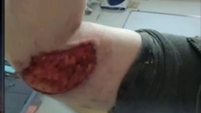 ضحية كلب سيتى ستارز للنيابة: فوجئت بهجومه عليّ والتهام ذراعي