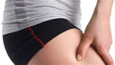 أسباب آلام الفخذ وأعراضها وطرق علاجها