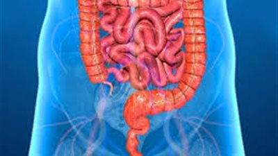 5 نصائح تحمي من الإصابة بالتهابات القولون