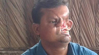 شاهد.. رجل يكشف عن وجهه لأول مرة منذ هجوم نمر عليه من 20 عاما