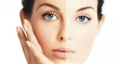 الخميرة وعسل النحل الأفضل للتخلص من اسمرار البشرة