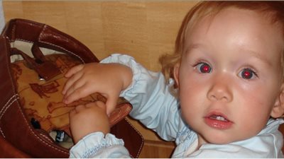 تعرفي على أسباب السرقة عند طفلك