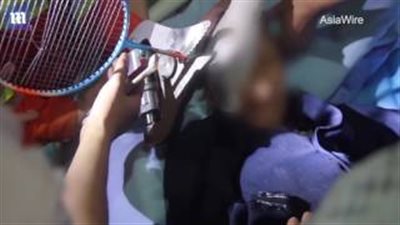 بالفيديو.. حادث مروع لمضرب يخترق جمجمة جدة طار من يد حفيدتها