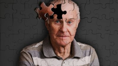 دراسة: تقدم فى أبحاث إنتاج مصل لمكافحة 