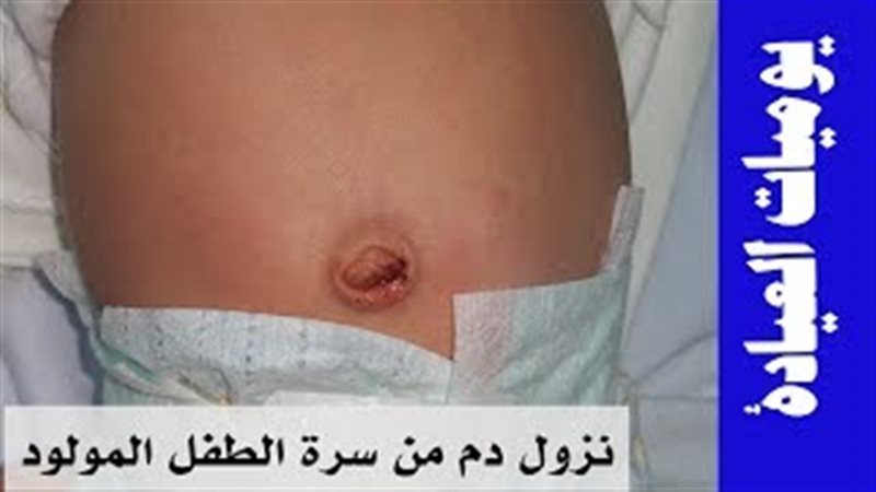 فيتو