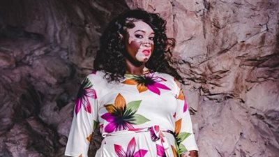 بالصور.. سيدة تحول البهاق إلى تميمة حظ