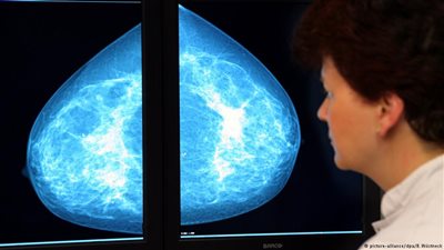 خلايا الجلد.. أحدث طرق علاج سرطان المخ؟!