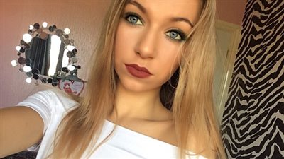 بالصور.. أحمر شفاه مقلد يتسبب في ورم فم فتاة