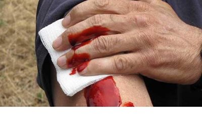 كيف تسعف المصاب بنزيف خارجي في أسرع وقت؟