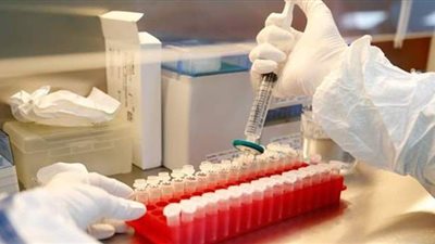 وزير الصحة الروسي يعلن موعد نشر الأبحاث المتعلقة بأول لقاح ضد 