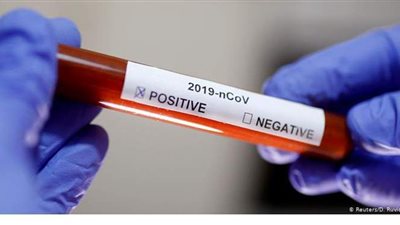 موظف عراقي يسرق مسحات كورونا ويبيعها في مختبره الخاص