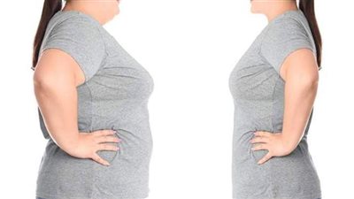 استشاري جراحات: الجي بلازما فكرة حديثة لشفط الدهون بدون آثار جانبية