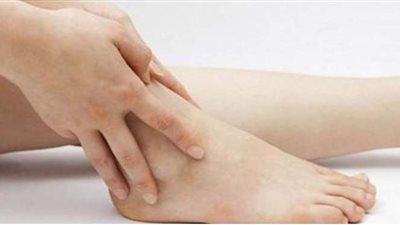 أستاذ جراحة أوعية يوضح أعراض تجلط الأوردة العميقة في الساقين وكيفية علاجها بالقسطرة