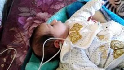 فحص 100 ألف حالة في مبادرة رئيس الجمهورية لعلاج السمع عند الأطفال | صور