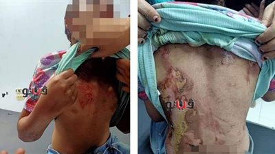 بطريقة وحشية .. ضابط مفصول وزوجته المغربية  يعذبان طفلة تعمل لديهما بكفر الشيخ | صور