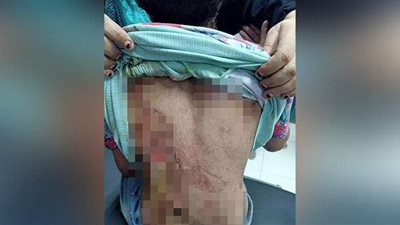 القصة الكاملة لتعذيب طفلة 9 سنوات على يد ظابط مفصول وزوجته المغربية (صور)