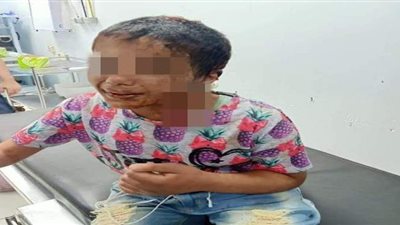 نيابة طنطا تحقق في واقعة الطفلة ضحية التعذيب