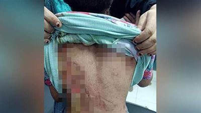 لتعذيبه الطفلة 