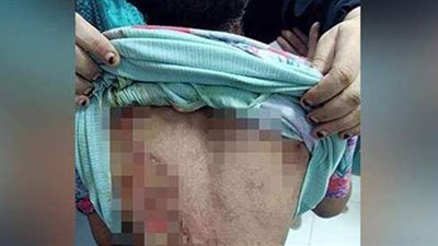 ضبط والدة طفلة التعذيب  على يد ضابط مفصول وزوجته بكفر الشيخ