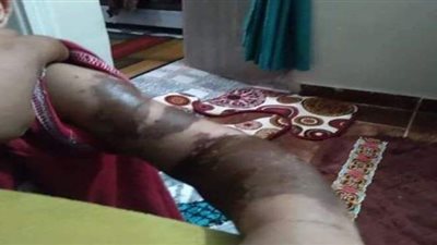 قاضي المعارضات يأمر بتجديد حبس المتهمين بإلقاء ماء نار علي المعازيم بفرح في شبرا الخيمة