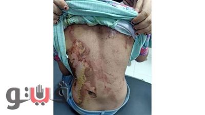 حقوق الطفل بكفر الشيخ: أشقاء الطفلة أمنية تعرضوا لانتهاكات ووالدتهم استغلتهم